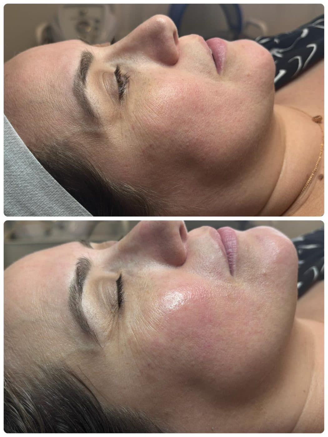 Regular Facial