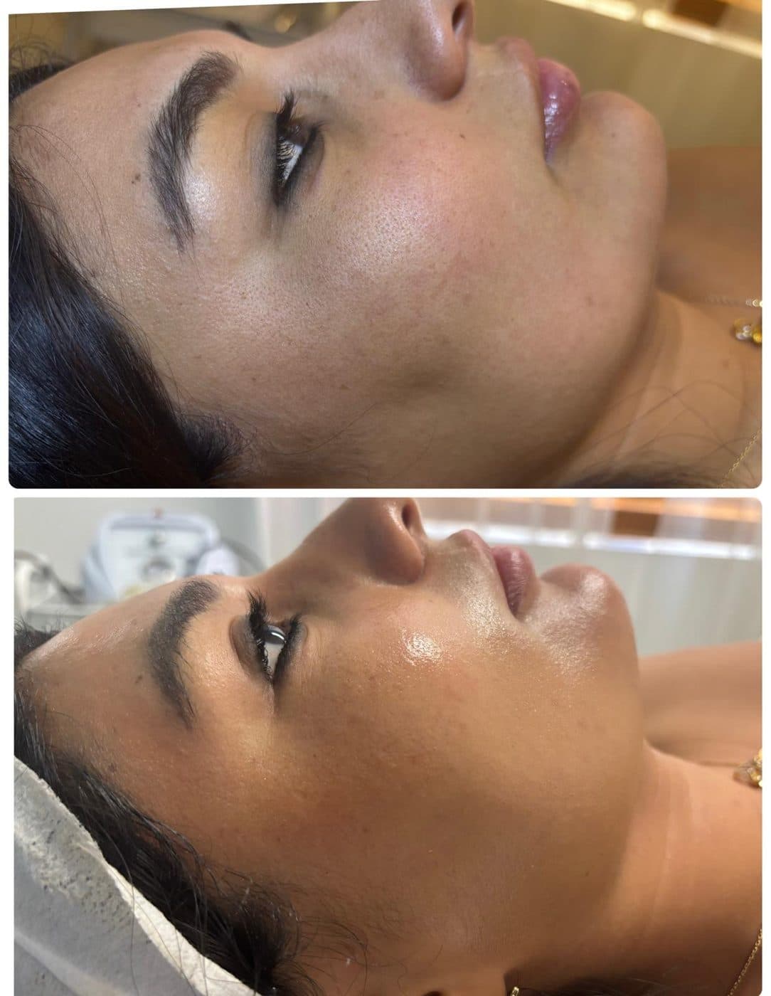 Deep Cleansing Facial