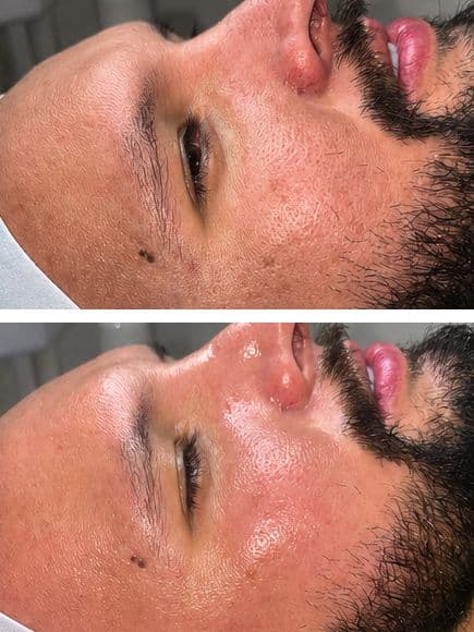 Deep Cleansing Facial