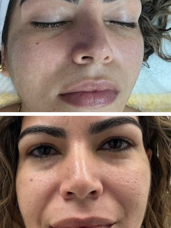 Skin Improvement Treatment
